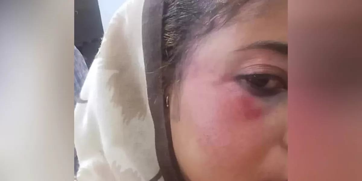 السودان: “لجنة العدالة” تطالب بفتح تحقيق حول الاعتداء على المحامية ريم عبد اللطيف في “كسلا” ومحاسبة المسؤولين