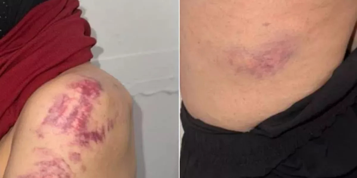 ليبيا: لجنة العدالة ترصد تعذيب واحتجاز تعسفي لمواطنة في البيضاء والامتناع عن تنفيذ أمر النيابة بالإفراج عنها