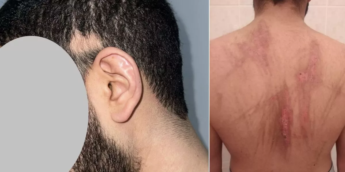 ليبيا: لجنة العدالة ترصد اختطاف مواطن وتعذيبه واحتجازه 9 أشهر دون محاكمة